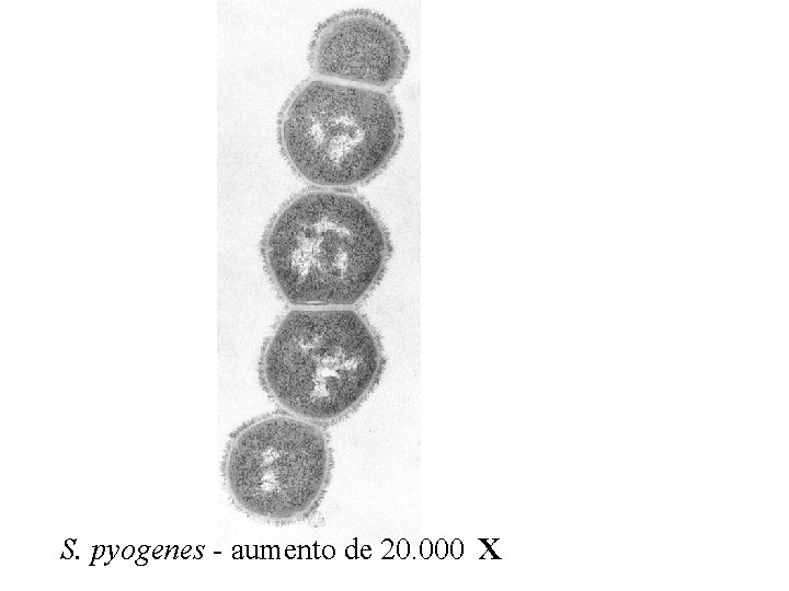 S. pyogenes - aumento de 20. 000 x 