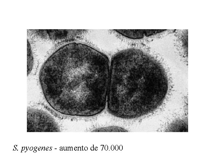 S. pyogenes - aumento de 70. 000 