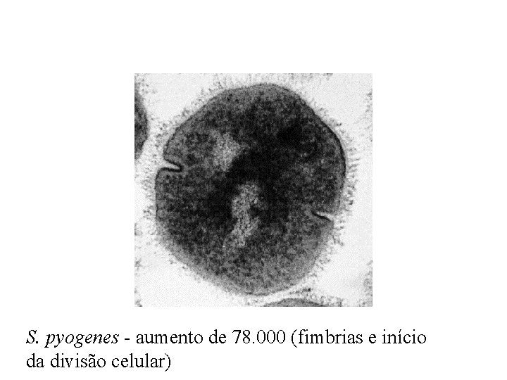 S. pyogenes - aumento de 78. 000 (fimbrias e início da divisão celular) 