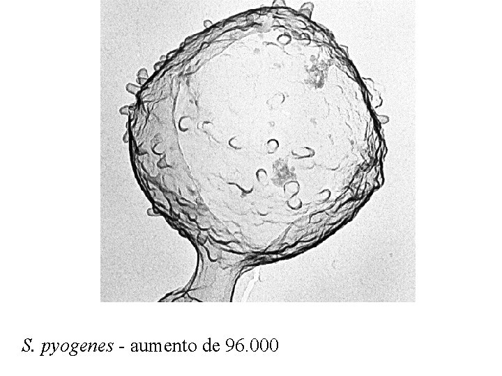 S. pyogenes - aumento de 96. 000 