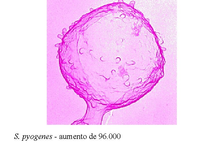 S. pyogenes - aumento de 96. 000 