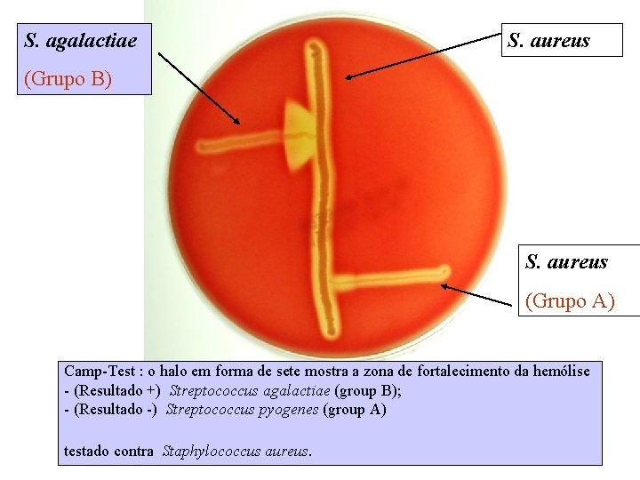 S. agalactiae S. aureus (Grupo B) S. aureus (Grupo A) Camp-Test : o halo