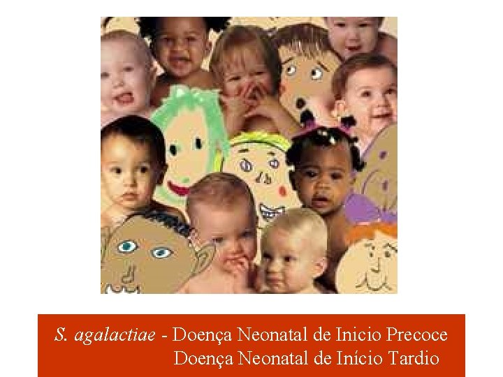 S. agalactiae - Doença Neonatal de Inicio Precoce Doença Neonatal de Início Tardio 