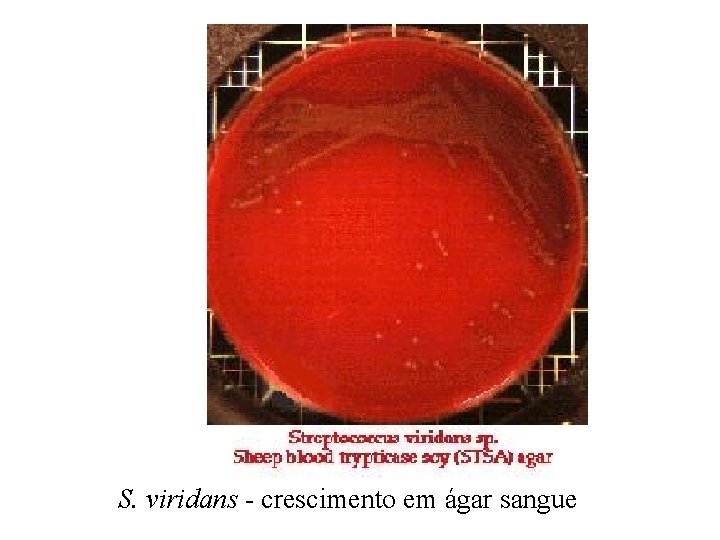 S. viridans - crescimento em ágar sangue 