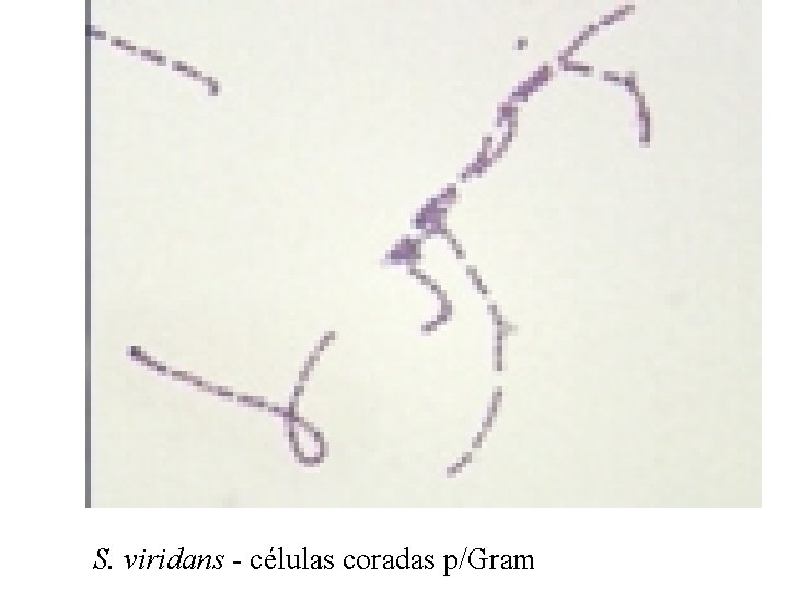 S. viridans - células coradas p/Gram 