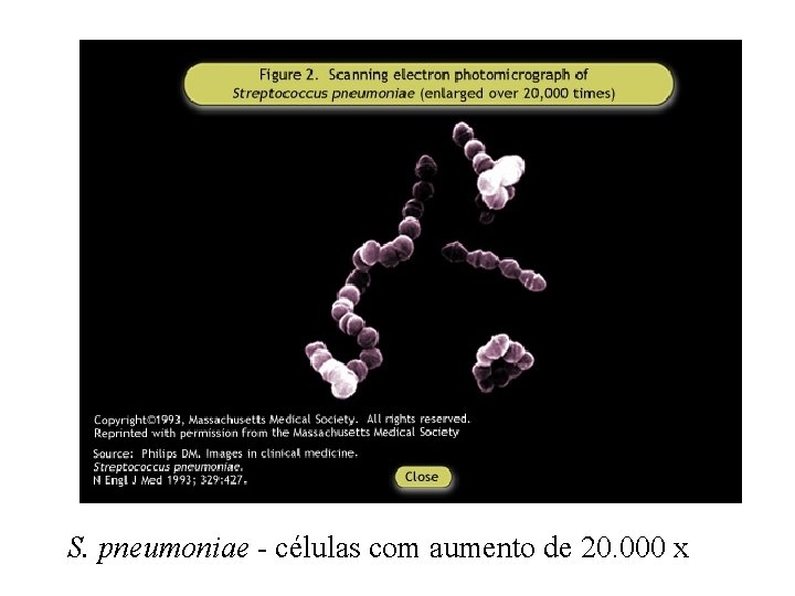 S. pneumoniae - células com aumento de 20. 000 x 