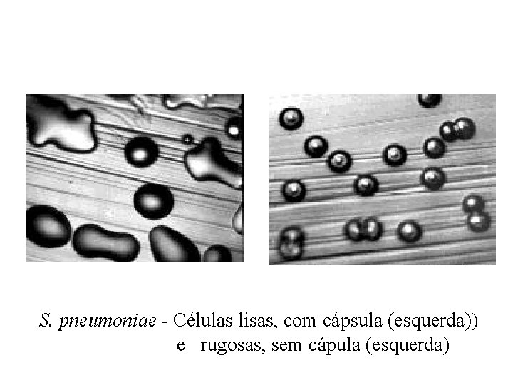 S. pneumoniae - Células lisas, com cápsula (esquerda)) e rugosas, sem cápula (esquerda) 