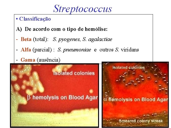 Streptococcus • Classificação A) De acordo com o tipo de hemólise: - Beta (total):