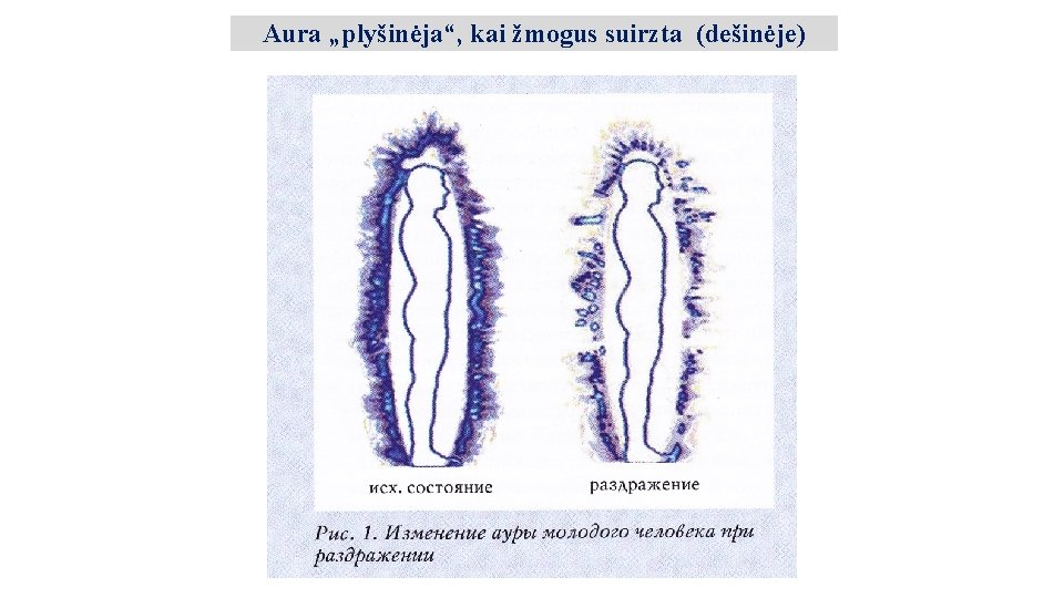 Aura „plyšinėja“, kai žmogus suirzta (dešinėje) 