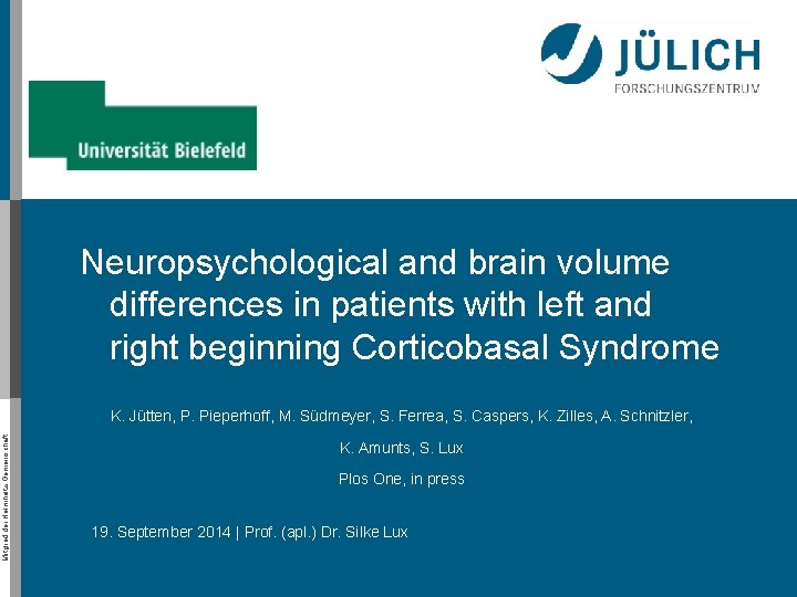 Neuropsychological and brain volume differences in patients with left and right beginning Corticobasal Syndrome