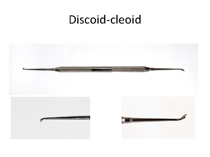Discoid-cleoid 
