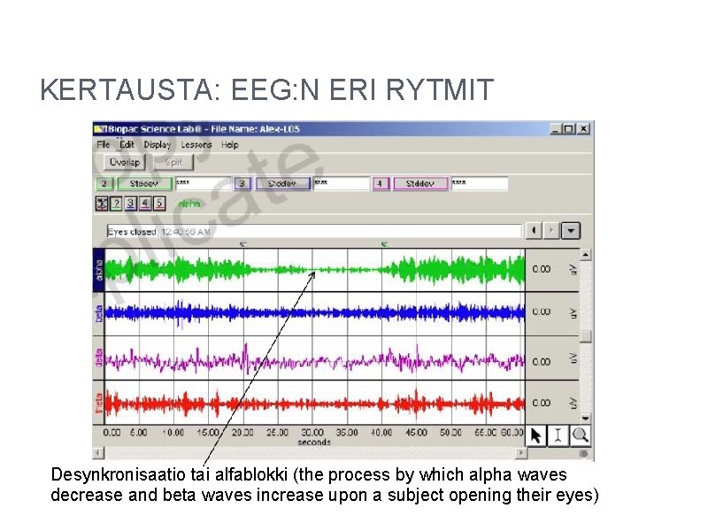 KERTAUSTA: EEG: N ERI RYTMIT Desynkronisaatio tai alfablokki (the process by which alpha waves KERTAUSTA: EEG: N ERI RYTMIT Desynkronisaatio tai alfablokki (the process by which alpha waves