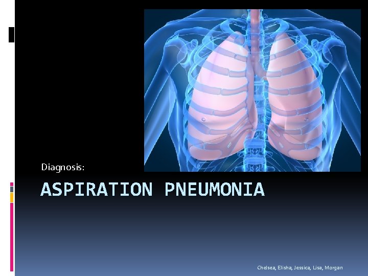 Diagnosis: ASPIRATION PNEUMONIA Chelsea, Elisha, Jessica, Lisa, Morgan 