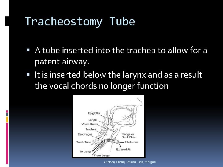 Tracheostomy Tube A tube inserted into the trachea to allow for a patent airway.