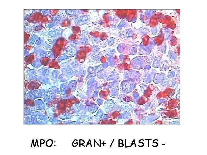 MPO: GRAN+ / BLASTS - 