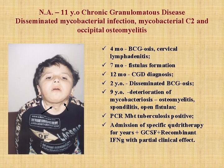 N. A. – 11 y. o Chronic Granulomatous Disease Disseminated mycobacterial infection, mycobacterial C N. A. – 11 y. o Chronic Granulomatous Disease Disseminated mycobacterial infection, mycobacterial C