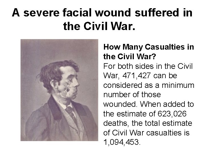 A severe facial wound suffered in the Civil War. How Many Casualties in the