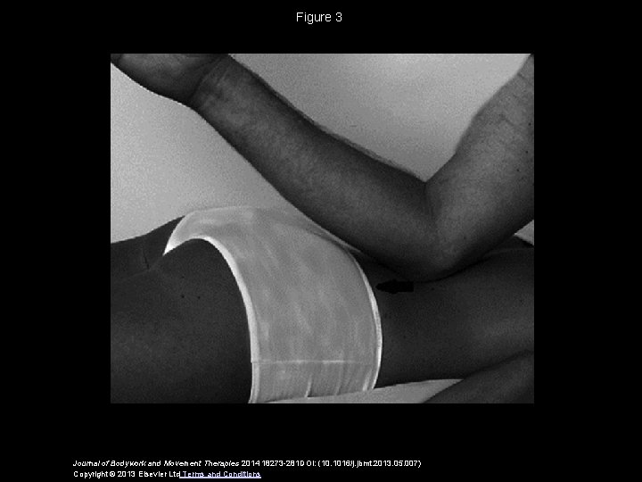 Figure 3 Journal of Bodywork and Movement Therapies 2014 18273 -281 DOI: (10. 1016/j.