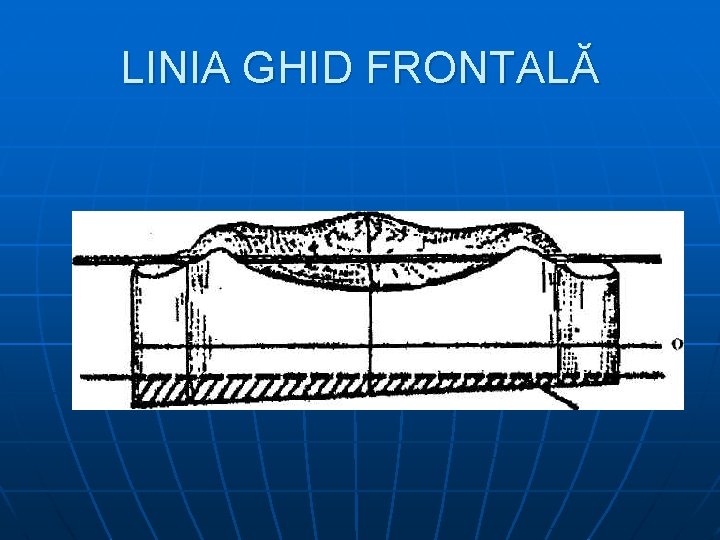 LINIA GHID FRONTALĂ 