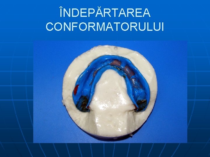 ÎNDEPĂRTAREA CONFORMATORULUI 