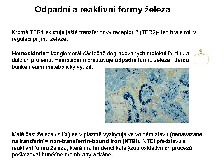 Odpadní a reaktivní formy železa Kromě TFR 1 existuje ještě transferinový receptor 2 (TFR