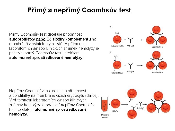 Přímý a nepřímý Coombsův test Přímý Coombsův test detekuje přítomnost autoprotilátky nebo C 3 Přímý a nepřímý Coombsův test Přímý Coombsův test detekuje přítomnost autoprotilátky nebo C 3