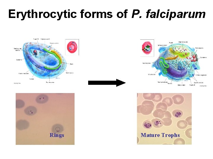 Erythrocytic forms of P. falciparum Rings Mature Trophs 