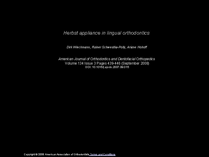 Herbst appliance in lingual orthodontics Dirk Wiechmann, Rainer Schwestka-Polly, Ariane Hohoff American Journal of