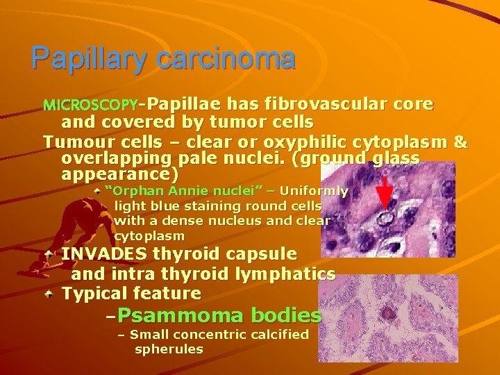 Papillary carcinoma MICROSCOPY-Papillae has fibrovascular core and covered by tumor cells Tumour cells –