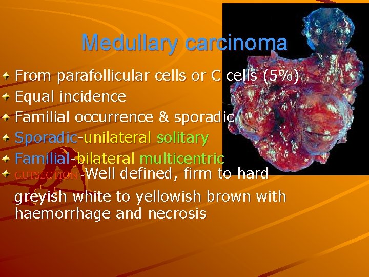 Medullary carcinoma From parafollicular cells or C cells (5%) Equal incidence Familial occurrence &