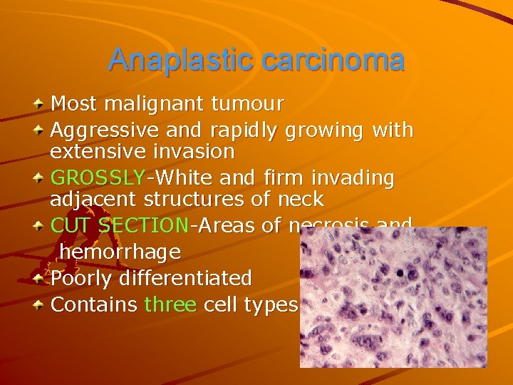 Anaplastic carcinoma Most malignant tumour Aggressive and rapidly growing with extensive invasion GROSSLY-White and