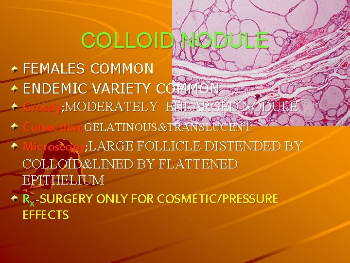 COLLOID NODULE FEMALES COMMON ENDEMIC VARIETY COMMON Grossly; MODERATELY ENLARGED NODULE Cutsection; GELATINOUS&TRANSLUCENT Microscopy;