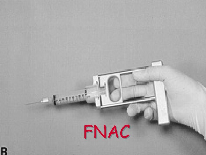 FNAC 