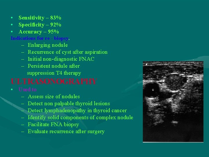  • Sensitivity – 83% • Specificity – 92% • Accuracy – 95% Indications