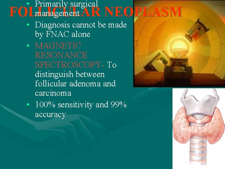  • Primarily surgical management FOLLICULAR NEOPLASM • Diagnosis cannot be made by FNAC