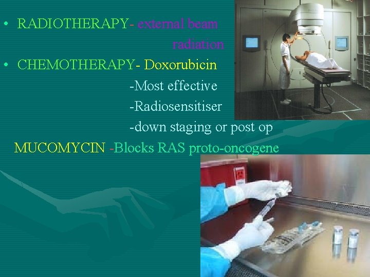  • RADIOTHERAPY- external beam radiation • CHEMOTHERAPY- Doxorubicin -Most effective -Radiosensitiser -down staging