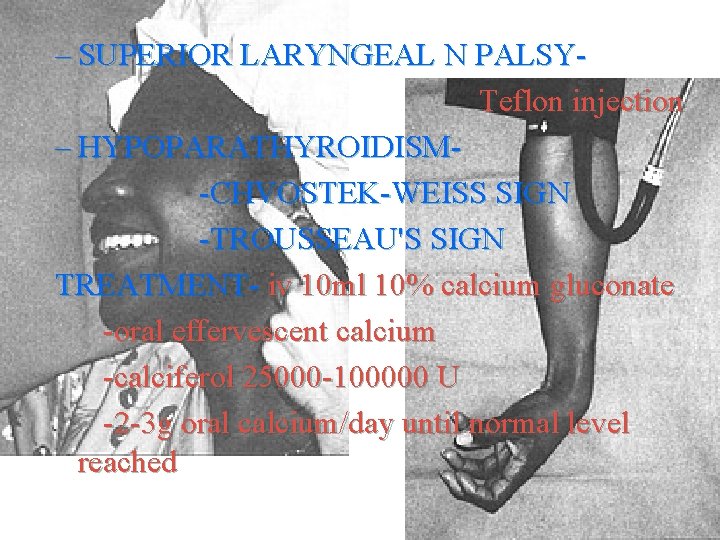 – SUPERIOR LARYNGEAL N PALSYTeflon injection – HYPOPARATHYROIDISM-CHVOSTEK-WEISS SIGN -TROUSSEAU'S SIGN TREATMENT- iv 10