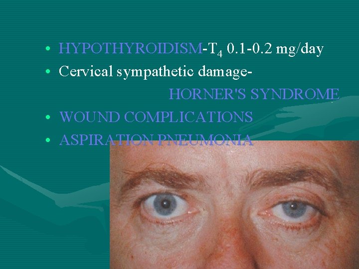  • HYPOTHYROIDISM-T 4 0. 1 -0. 2 mg/day • Cervical sympathetic damage. HORNER'S