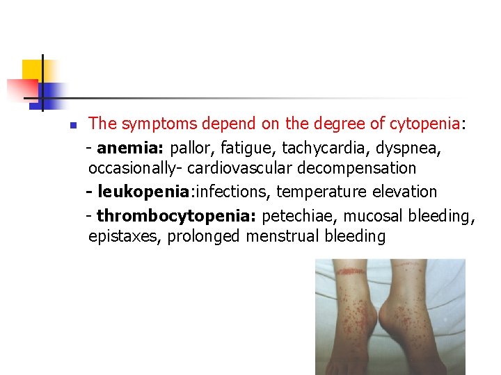 n The symptoms depend on the degree of cytopenia: - anemia: pallor, fatigue, tachycardia,