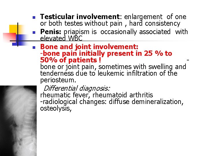 n n n Testicular involvement: enlargement of one or both testes without pain ,