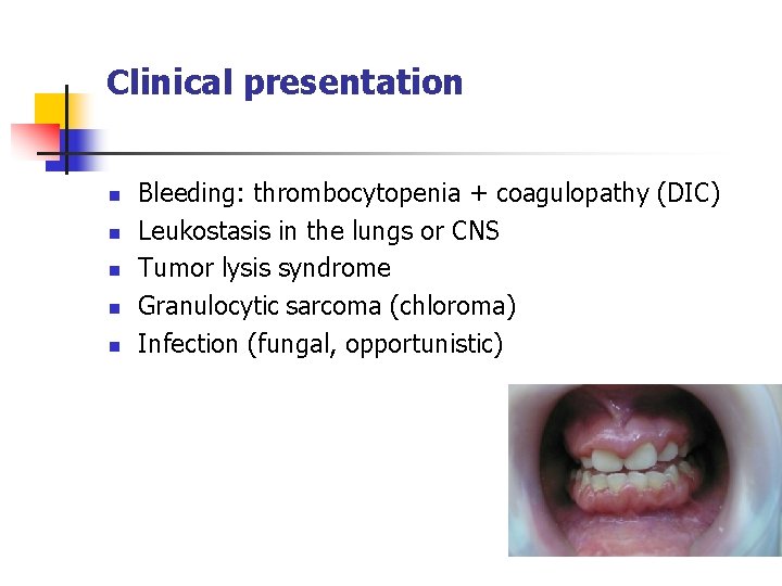 Clinical presentation n n Bleeding: thrombocytopenia + coagulopathy (DIC) Leukostasis in the lungs or