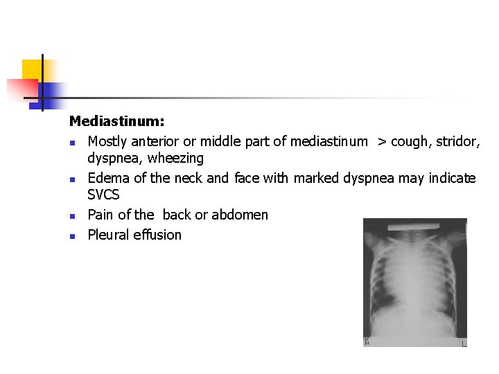 Mediastinum: n Mostly anterior or middle part of mediastinum > cough, stridor, dyspnea, wheezing