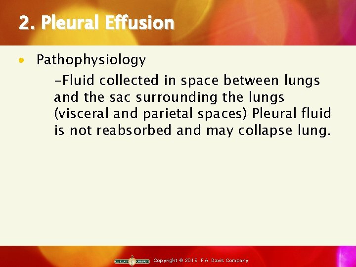 2. Pleural Effusion · Pathophysiology -Fluid collected in space between lungs and the sac