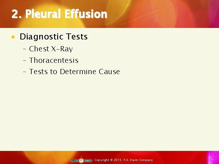 2. Pleural Effusion · Diagnostic Tests ‒ Chest X-Ray ‒ Thoracentesis ‒ Tests to