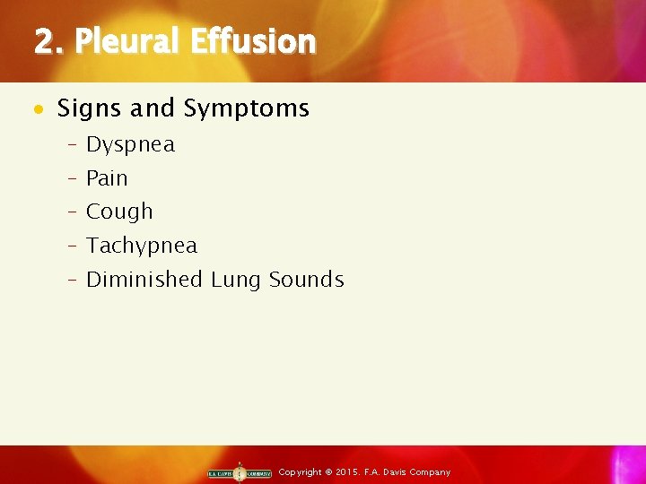 2. Pleural Effusion · Signs and Symptoms ‒ Dyspnea ‒ Pain ‒ Cough ‒