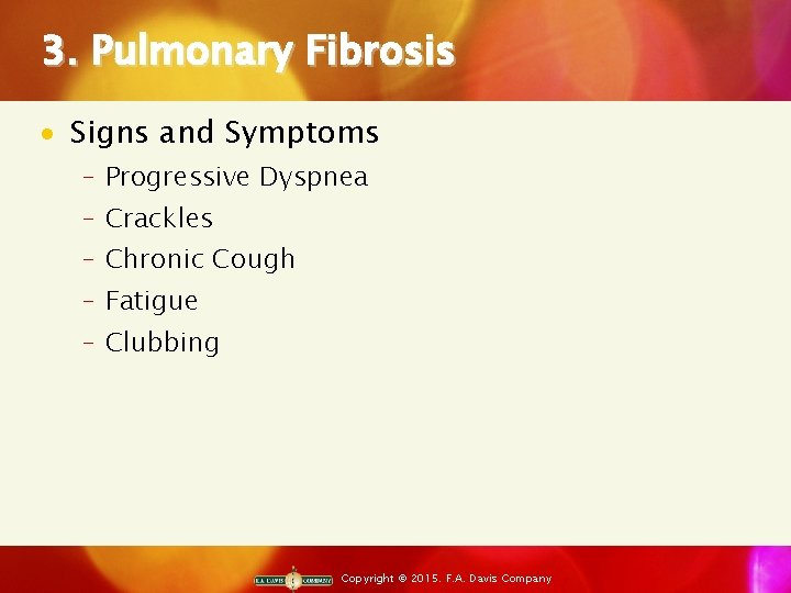 3. Pulmonary Fibrosis · Signs and Symptoms ‒ Progressive Dyspnea ‒ Crackles ‒ Chronic