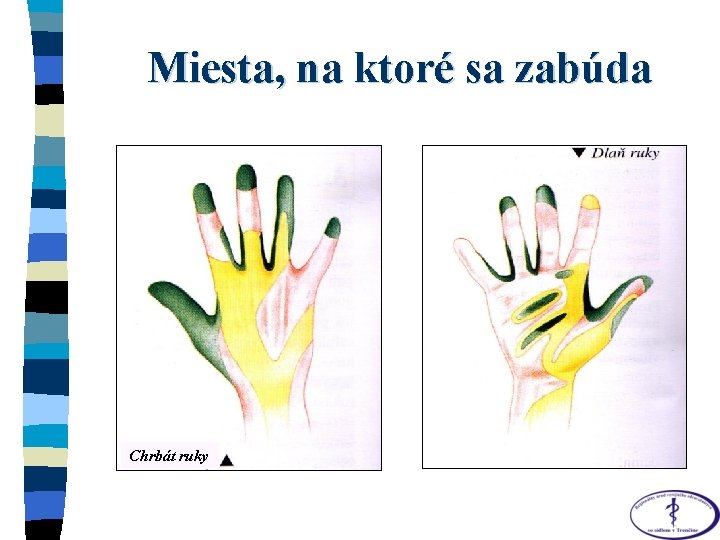 Miesta, na ktoré sa zabúda Chrbát ruky 