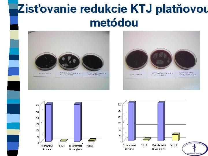 Zisťovanie redukcie KTJ platňovou metódou 