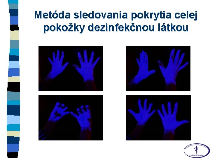 Metóda sledovania pokrytia celej pokožky dezinfekčnou látkou Metóda sledovania pokrytia celej pokožky dezinfekčnou látkou