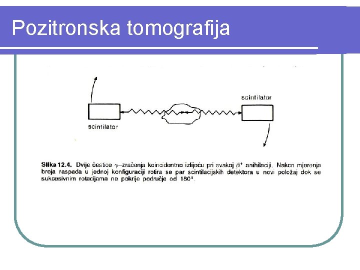 Pozitronska tomografija 